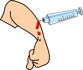 一针见血 - yī zhēn jiàn xiě