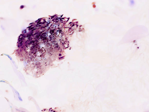 粘虫 - nián chóng