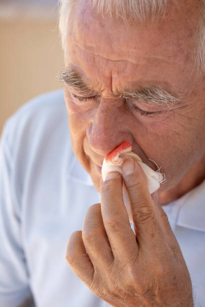 鼻疮 - bí chuāng