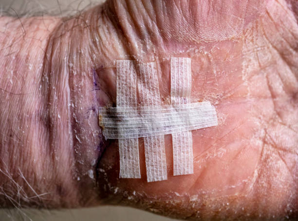 伤号 - shāng hào