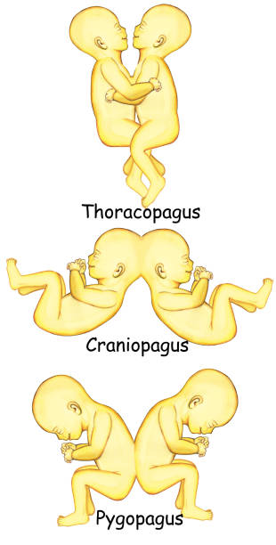 成见 - chéng jiàn