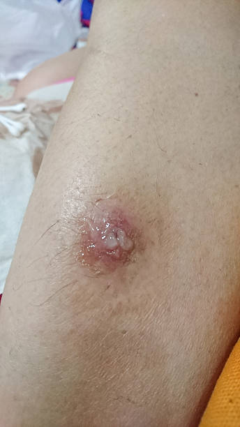 病变 - bìng biàn