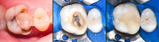 开腔 - kāi qiāng