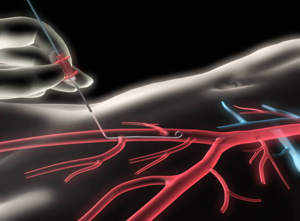 烧灼 - shāo zhuó