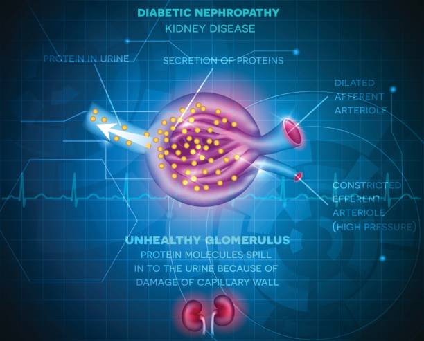 肾病 - shèn bìng