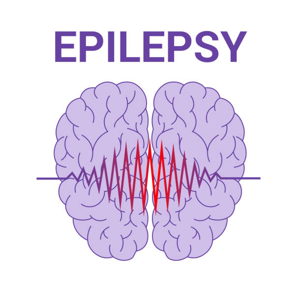 痫证 - xián zhèng