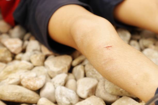 轻伤 - qīng shāng