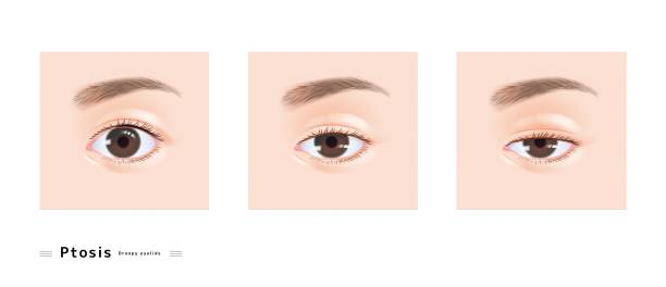 整形 - zhěng xíng