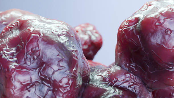 肿块 - zhǒng kuài